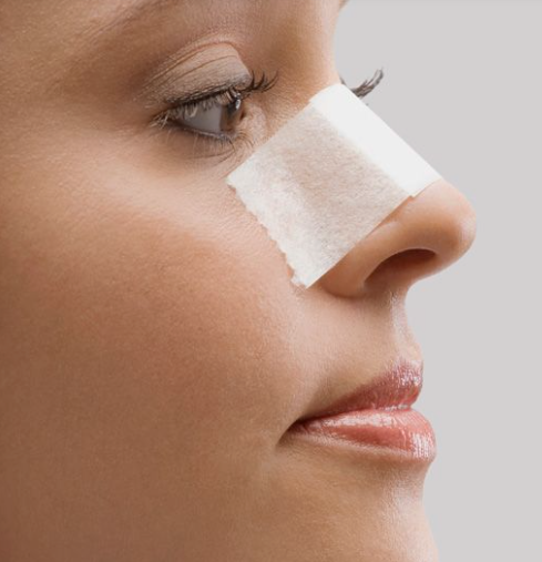 ترمیم جراحی زیبایی بینی